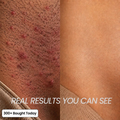 Her+ Anti-Hair Growth Oil