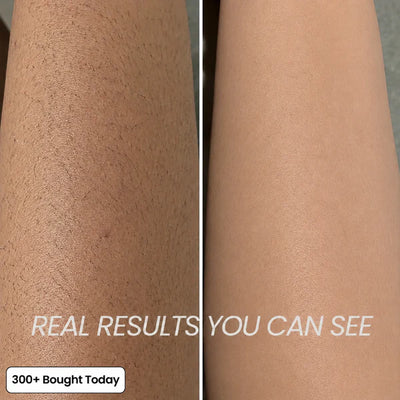 Her+ Anti-Hair Growth Oil