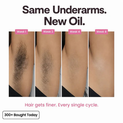 Her+ Anti-Hair Growth Oil