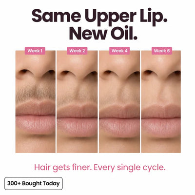 Her+ Anti-Hair Growth Oil